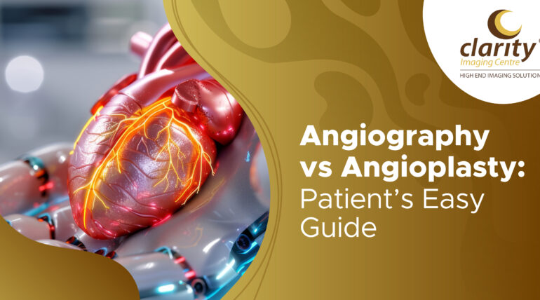 Difference Between Angiography and Angioplasty - A Patient's Guide