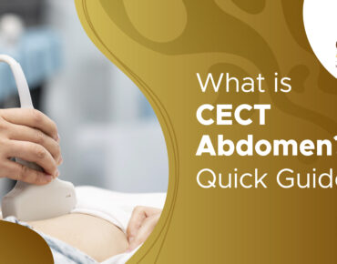 What is CECT Abdomen? Purpose, Procedure & Benefits Explained