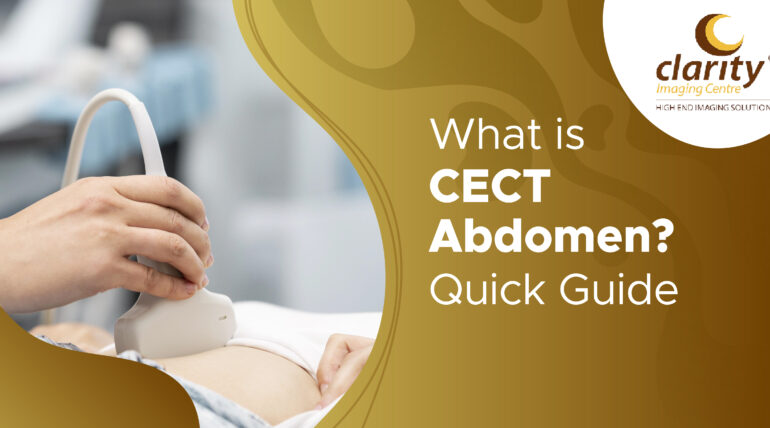 What is CECT Abdomen? Purpose, Procedure & Benefits Explained