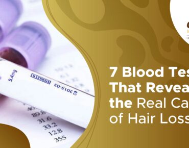 blood test for hair loss