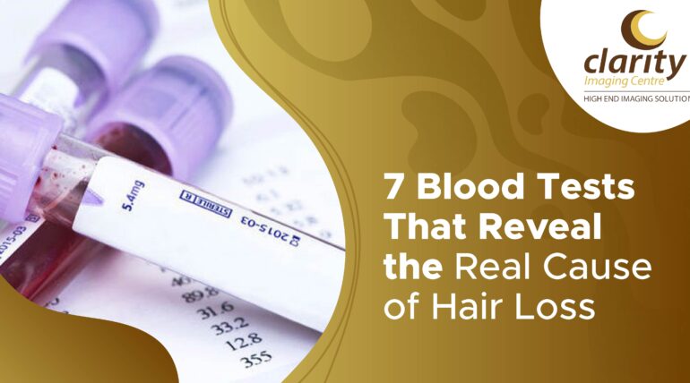 blood test for hair loss
