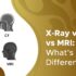 difference between x ray ct scan and mri