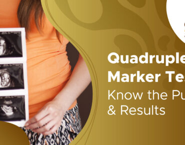 Quadruple Marker Test: Purpose, Procedure & Results