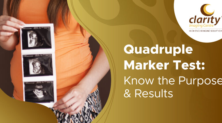 Quadruple Marker Test: Purpose, Procedure & Results