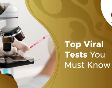 viral infection blood test