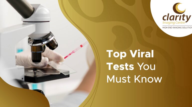 viral infection blood test