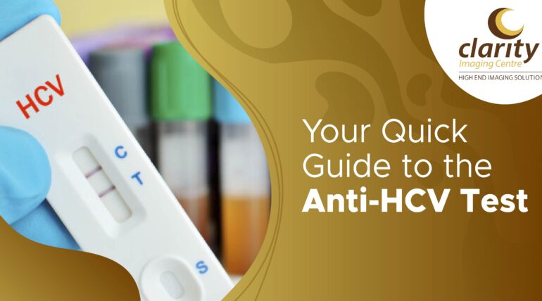anti HCV test