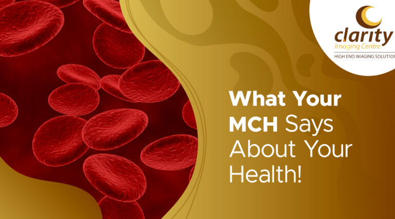 MCH in a Blood Test (Mean Corpuscular Haemoglobin)