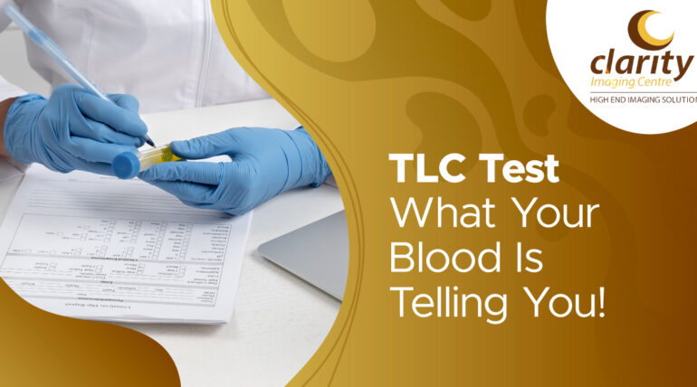 Understanding TLC normal range