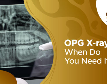 Orthopantomogram X-ray