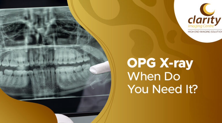 Orthopantomogram X-ray