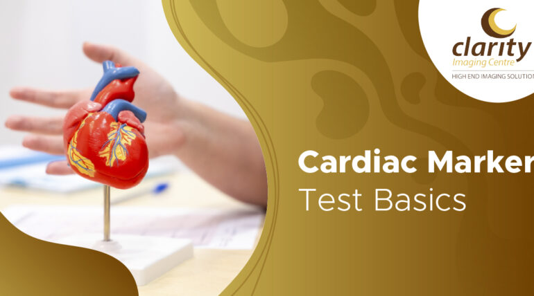 cardiac marker test