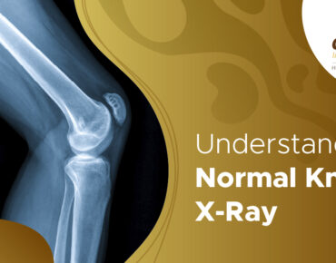 normal knee X-ray