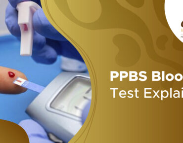 Ppbs test