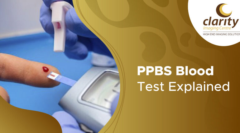 Ppbs test