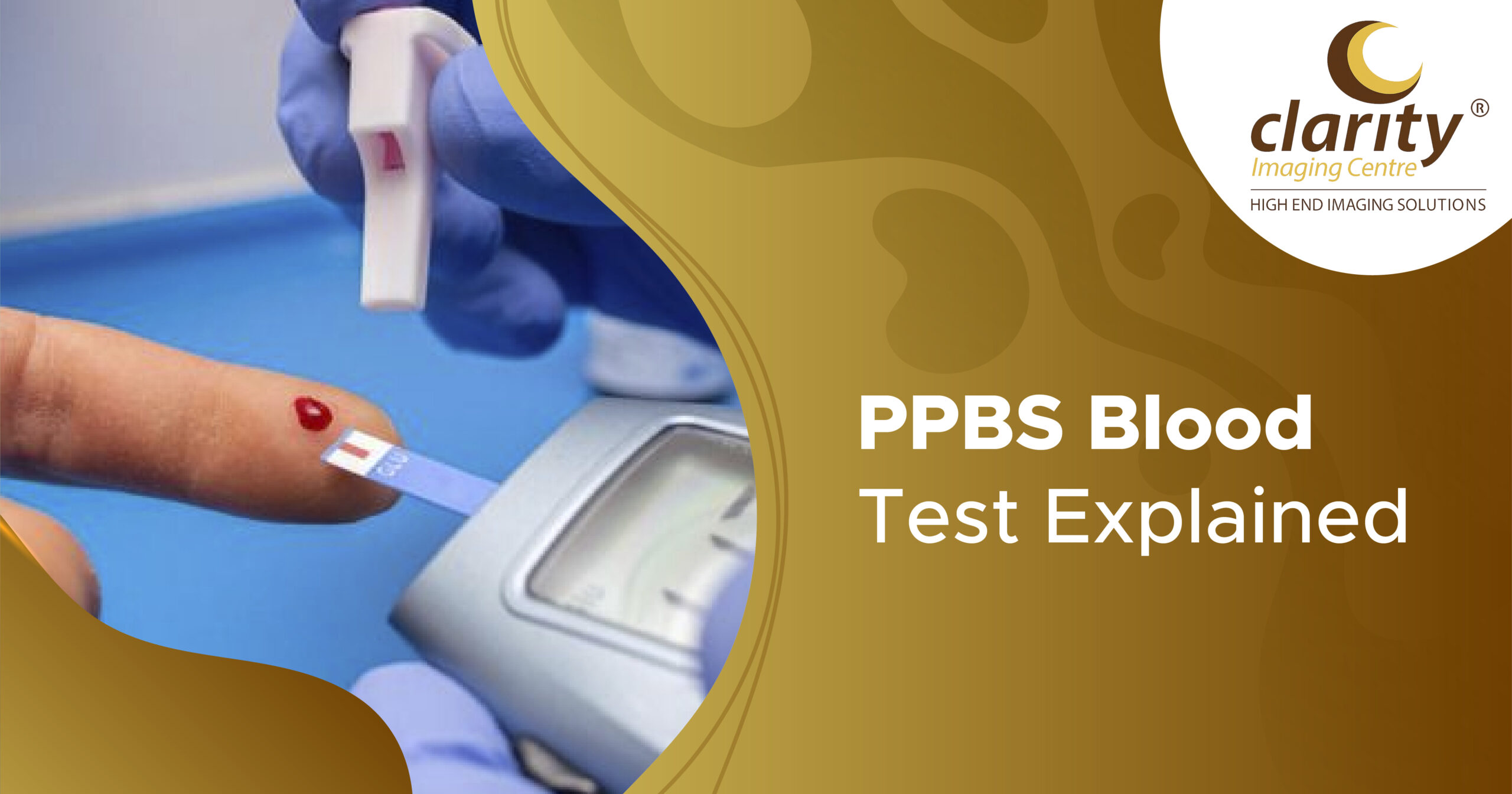 What Is Pp In Diabetes