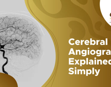 cerebral angiogram