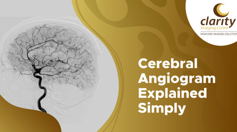 cerebral angiogram