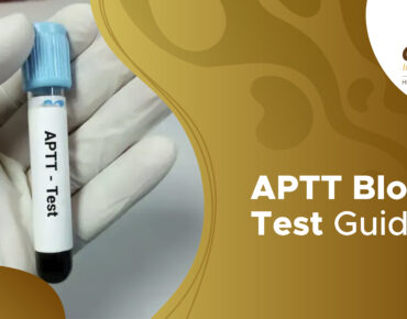 APTT test