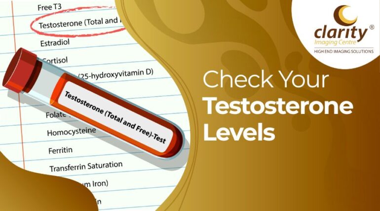 Close-up of blood collection tube labeled for testosterone hormone test.