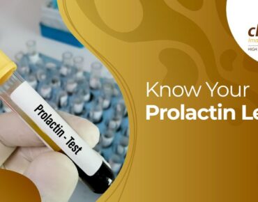 Blood collection tube labeled for prolactin hormone test.