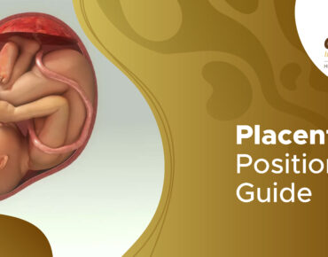 posterior placenta