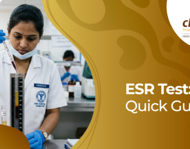 ESR blood test