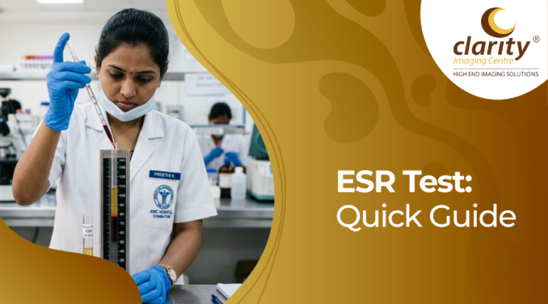 ESR blood test