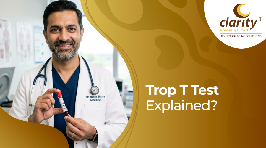 Normal Trop Trop T Test: Normal Levels, Purpose and More