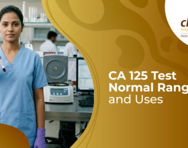 CA 125 blood test tube and lab result report for ovarian cancer screening