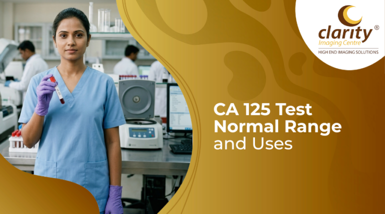 CA 125 blood test tube and lab result report for ovarian cancer screening
