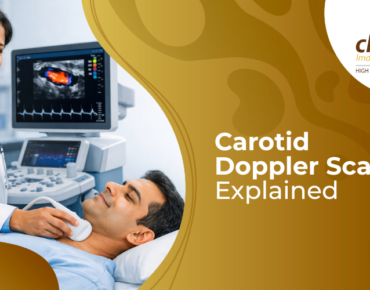 Carotid Doppler ultrasound scan showing blood flow in neck arteries