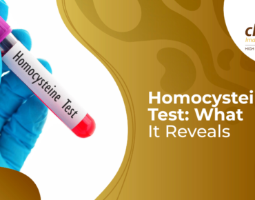 homocysteine test