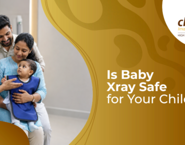 baby X-ray