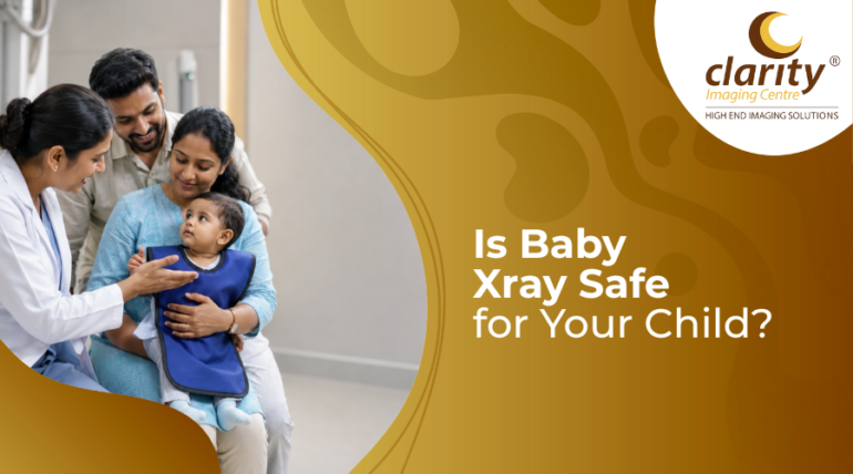 baby X-ray
