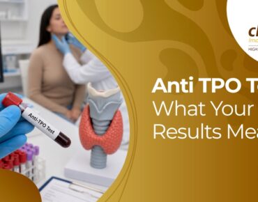 anti tpo test