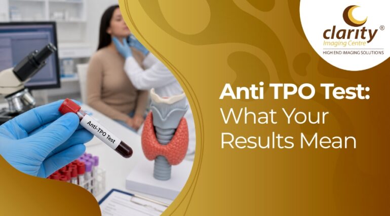 anti tpo test