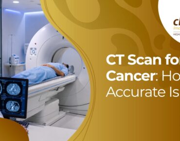 can cancer be detected in CT scan