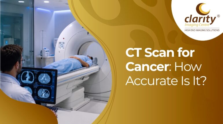 can cancer be detected in CT scan