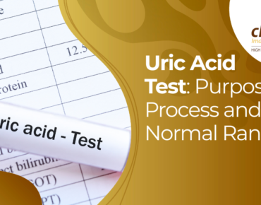 uric acid test