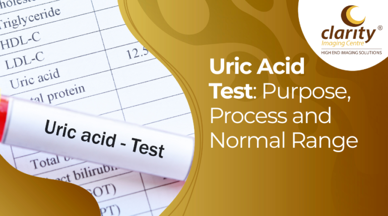 uric acid test