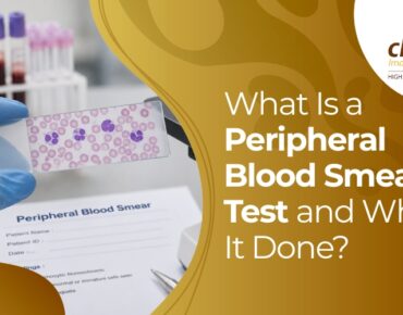 peripheral blood smear test