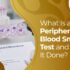 peripheral blood smear test