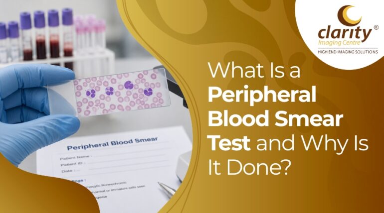 peripheral blood smear test