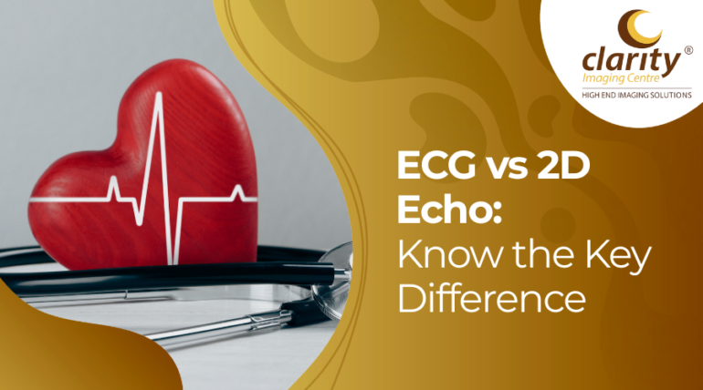 ECG vs 2D Echo