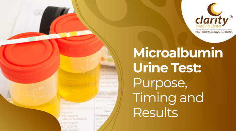 microalbumin urine test