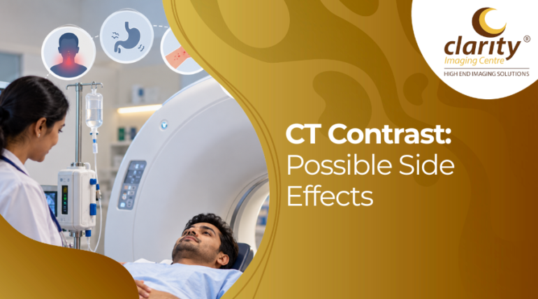 CT contrast side effects