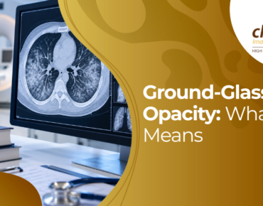 ground-glass opacity