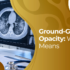 ground-glass opacity