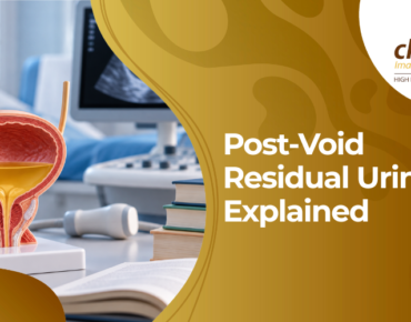 post void residual urine
